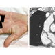 The woman’s hand, next to a CT image of her lungs.